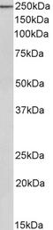 Actinin Alpha 1 antibody, 43-554, ProSci, Western Blot image 