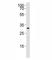 CCAAT Enhancer Binding Protein Beta antibody, F52597-0.4ML, NSJ Bioreagents, Western Blot image 