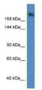 WD Repeat Domain 87 antibody, NBP1-91510, Novus Biologicals, Western Blot image 