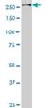 Stabilin 1 antibody, H00023166-A01, Novus Biologicals, Western Blot image 