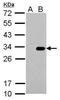 Herpes Simplex Virus tag antibody, NBP2-43815, Novus Biologicals, Western Blot image 