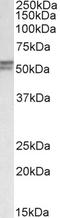 Diacylglycerol O-Acyltransferase 1 antibody, LS-B9542, Lifespan Biosciences, Western Blot image 