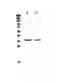 CD8 antibody, A02236-1, Boster Biological Technology, Western Blot image 