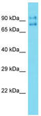 Tigger Transposable Element Derived 5 antibody, TA333421, Origene, Western Blot image 