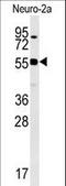 WD Repeat Domain 18 antibody, LS-C160573, Lifespan Biosciences, Western Blot image 