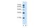 Major Facilitator Superfamily Domain Containing 12 antibody, GTX46588, GeneTex, Western Blot image 