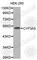 Zinc Finger C3HC-Type Containing 1 antibody, A1349, ABclonal Technology, Western Blot image 