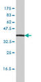 Interleukin 11 Receptor Subunit Alpha antibody, LS-C197522, Lifespan Biosciences, Western Blot image 