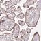 Methylenetetrahydrofolate Dehydrogenase (NADP+ Dependent) 1 Like antibody, PA5-56047, Invitrogen Antibodies, Immunohistochemistry paraffin image 