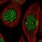 Transmembrane Protein 196 antibody, NBP1-93472, Novus Biologicals, Immunofluorescence image 