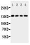 Laminin Subunit Gamma 2 antibody, PA5-79578, Invitrogen Antibodies, Western Blot image 