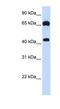 Guanylate Cyclase 1 Soluble Subunit Beta 1 antibody, NBP1-58869, Novus Biologicals, Western Blot image 