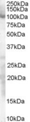 Complement Factor H antibody, 45-414, ProSci, Western Blot image 