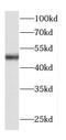 Trafficking Protein Particle Complex 13 antibody, FNab01122, FineTest, Western Blot image 