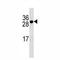 TNF Receptor Superfamily Member 17 antibody, F44619-0.4ML, NSJ Bioreagents, Western Blot image 