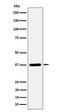 Syntaxin 16 antibody, M06602, Boster Biological Technology, Western Blot image 