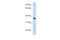 Lipocalin 12 antibody, A16605, Boster Biological Technology, Western Blot image 