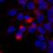 Brevican antibody, BAF4009, R&D Systems, Immunocytochemistry image 