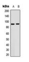Heat Shock Protein 90 Alpha Family Class B Member 1 antibody, orb393321, Biorbyt, Western Blot image 