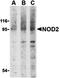 Transthyretin antibody, orb19235, Biorbyt, Western Blot image 