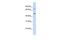 Kringle Containing Transmembrane Protein 1 antibody, GTX46605, GeneTex, Western Blot image 