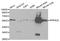 Protein Phosphatase 3 Catalytic Subunit Alpha antibody, A03026, Boster Biological Technology, Western Blot image 