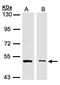 Glycerate Kinase antibody, PA5-28660, Invitrogen Antibodies, Western Blot image 