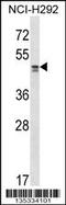 Transcriptional Adaptor 2A antibody, 58-092, ProSci, Western Blot image 