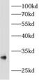 Archaelysin Family Metallopeptidase 1 antibody, FNab00385, FineTest, Western Blot image 