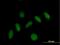 Pleckstrin Homology Domain Containing J1 antibody, H00055111-B01P, Novus Biologicals, Immunofluorescence image 