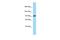 Seizure Related 6 Homolog antibody, A09811, Boster Biological Technology, Western Blot image 