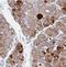 Transmembrane and coiled-coil domains protein 1 antibody, NBP2-30463, Novus Biologicals, Immunohistochemistry frozen image 