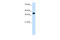 Zinc Finger And SCAN Domain Containing 16 antibody, 29-099, ProSci, Western Blot image 