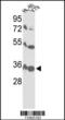 Voltage Dependent Anion Channel 1 antibody, MBS9212315, MyBioSource, Western Blot image 
