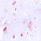 Pre-MRNA Processing Factor 18 antibody, orb214805, Biorbyt, Immunohistochemistry paraffin image 