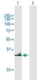 Hyaluronan Synthase 3 antibody, H00003038-B02P, Novus Biologicals, Western Blot image 