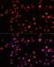 Mitochondrial E3 Ubiquitin Protein Ligase 1 antibody, LS-C748186, Lifespan Biosciences, Immunofluorescence image 