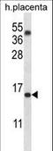 Transmembrane 4 L Six Family Member 18 antibody, LS-C203708, Lifespan Biosciences, Western Blot image 