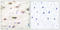 Glutamate Ionotropic Receptor AMPA Type Subunit 2 antibody, LS-C118130, Lifespan Biosciences, Immunohistochemistry paraffin image 