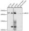 Ubiquitin Conjugating Enzyme E2 O antibody, A09217, Boster Biological Technology, Western Blot image 