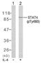 Signal Transducer And Activator Of Transcription 4 antibody, GTX78939, GeneTex, Western Blot image 