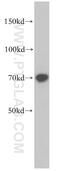 RUN And FYVE Domain Containing 2 antibody, 14137-1-AP, Proteintech Group, Western Blot image 
