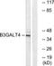 Beta-1,3-Galactosyltransferase 4 antibody, TA314796, Origene, Western Blot image 