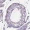 SPOC Domain Containing 1 antibody, NBP2-38187, Novus Biologicals, Immunohistochemistry frozen image 