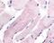 WNK1 antibody, 48-335, ProSci, Immunohistochemistry paraffin image 