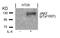 Janus Kinase 2 antibody, PA5-37618, Invitrogen Antibodies, Western Blot image 