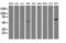 Chaperonin Containing TCP1 Subunit 8 Like 2 antibody, LS-C174276, Lifespan Biosciences, Western Blot image 