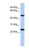 Transmembrane Protein 161B antibody, NBP1-91443, Novus Biologicals, Western Blot image 