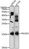 Pleckstrin Homology Like Domain Family A Member 3 antibody, LS-C747757, Lifespan Biosciences, Western Blot image 