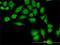Thioredoxin antibody, H00007295-M01, Novus Biologicals, Immunocytochemistry image 